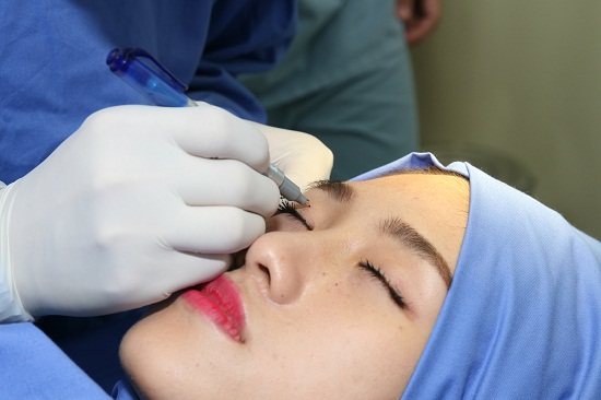 Quy trình thẩm mỹ mắt an toàn đạt chuẩn Hàn Quốc