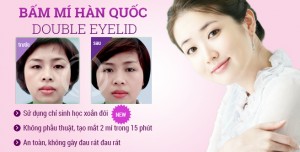 Bấm mí Hàn Quốc Double eyelid – Mắt đẹp tự nhiên sau 15 – 20 phút